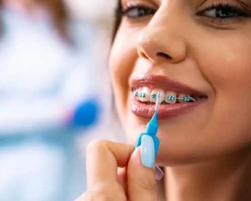 The Pre-Surgical Instructions From Your Implant Dentist